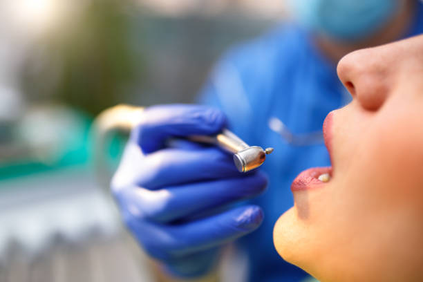Dental Bonding in Solomons, MD